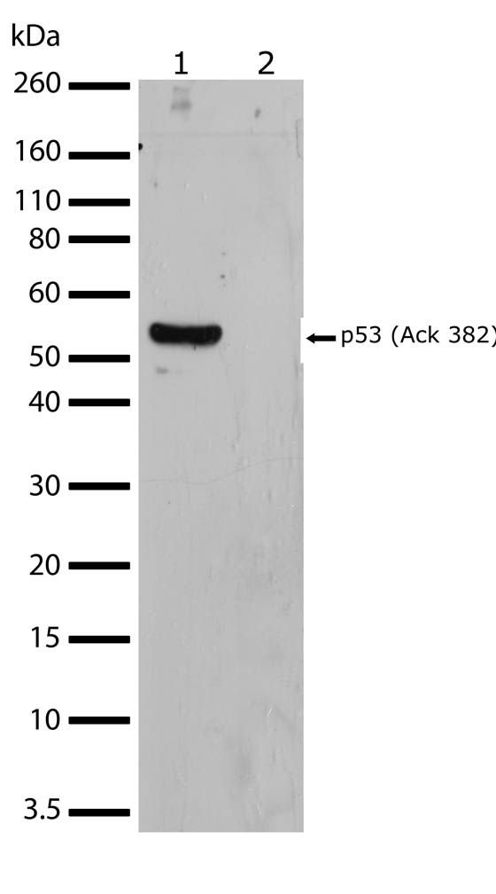 Rabbit Anti-Human p53 (Acetyl-Lys382) monoclonal antibody, clone 20 I24M25 (CABT-L1641)