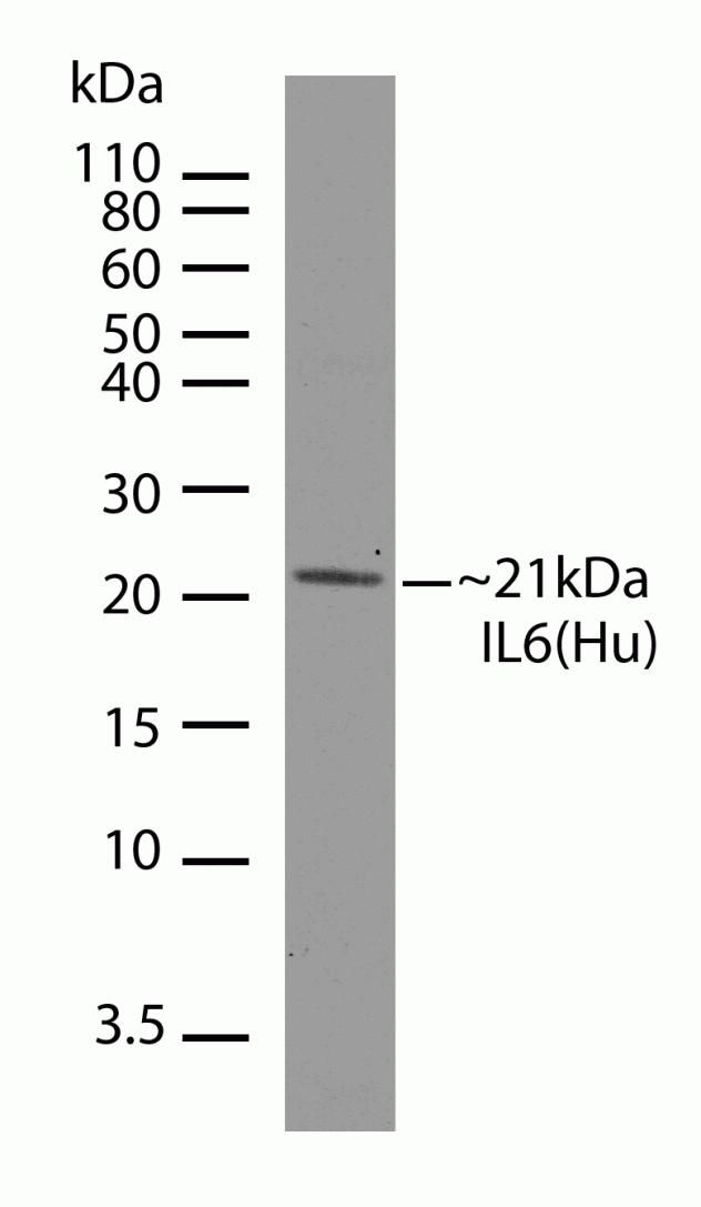 Rabbit Anti-Human IL-6 monoclonal antibody, clone 5I27M32 (CABT-L1410)