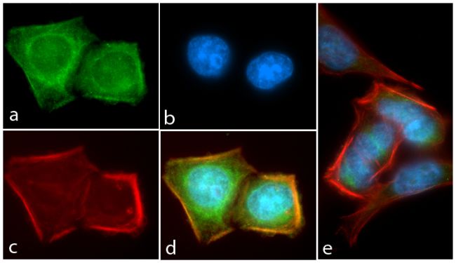 Rabbit Anti-Human AKT1 (phospho Thr308) monoclonal antibody, clone C29I23M32 (CABT-L1184)