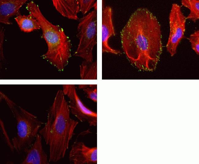 Rabbit Anti-Human FAK (phospho Tyr576) monoclonal antibody, clone 3I85M35 (CABT-L1556)