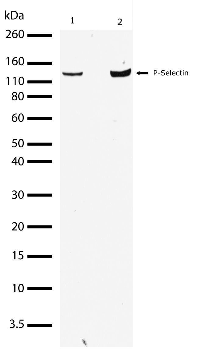 Rabbit Anti-Human P-Selectin monoclonal antibody, clone 4I30M20 (CABT-L1551)