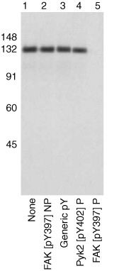 Rabbit Anti-Human FAK (phospho Tyr397) monoclonal antibody, clone 252-0 (CABT-L1555)