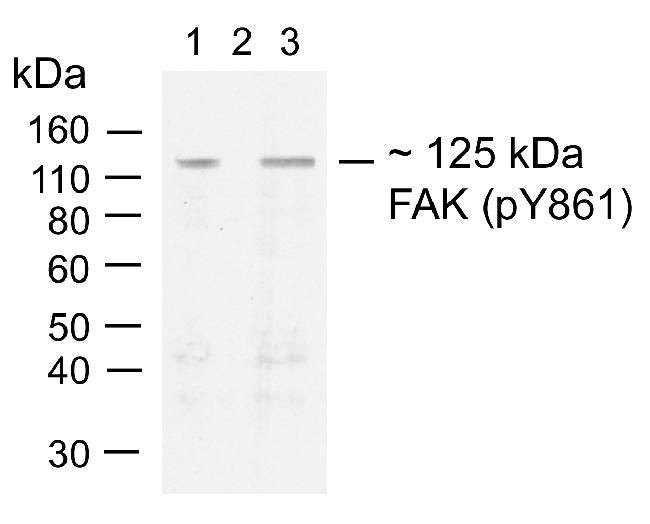 Rabbit Anti-FAK (phospho Tyr861) monoclonal antibody, clone 37I27M5 (CABT-L1557)