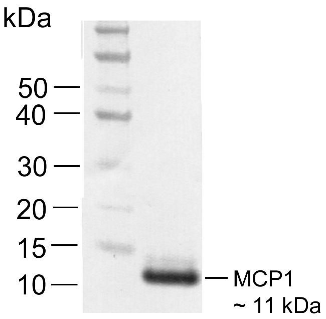 Recombinant Rabbit Anti-Human MCP-1 monoclonal antibody, clone 30I97M67 (DCABH-4176)