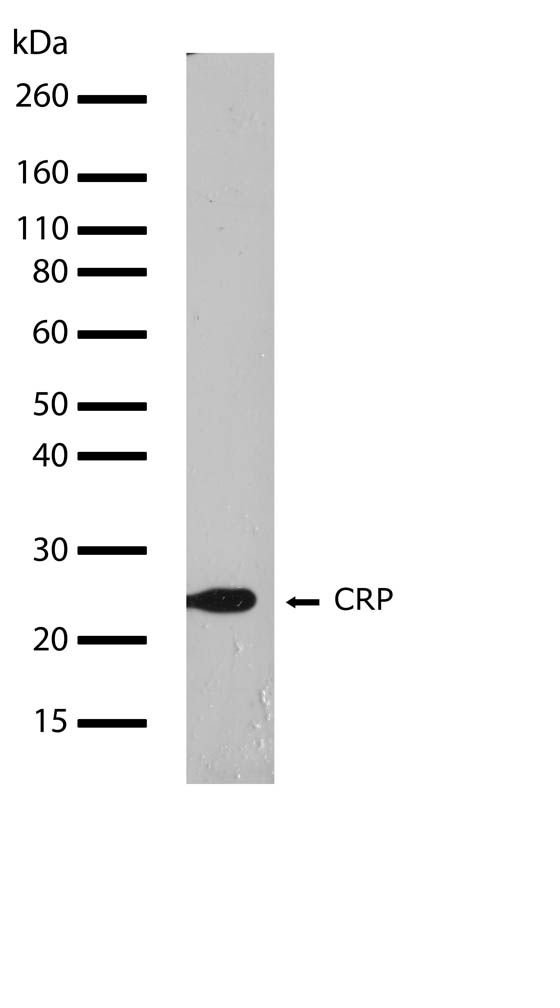 Rabbit Anti-Human CRP monoclonal antibody, clone 2I4M6 (CABT-BL8427)