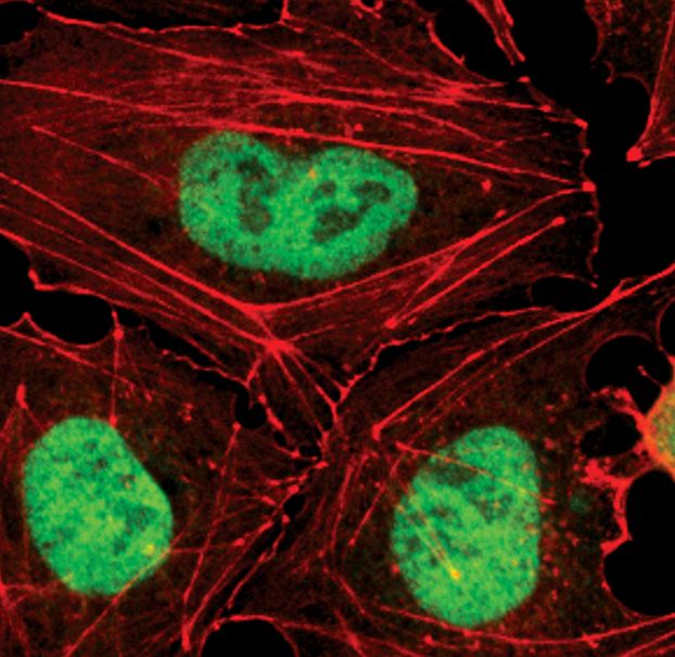 Rabbit Anti-Human OCT4 monoclonal antibody, clone U.742.0 (CABT-L1537)