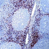 Rabbit Anti-Human CD8 monoclonal antibody, clone TQ27 (CABT-L1230)