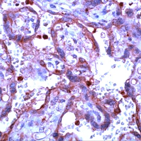 Rabbit Anti-Human MMP-9 polyclonal antibody (DCABH-3355)