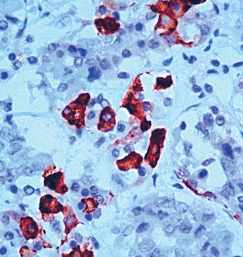 Rabbit Anti-Human TSH polyclonal antibody (CABT-L1873)