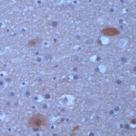 Rabbit Anti-Human SNCA polyclonal antibody (DCABH-1690)