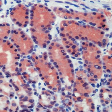 Rabbit Anti-Human CASP8 polyclonal antibody (CABT-L1707)