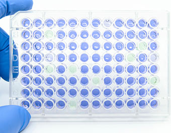 Matched Antibody Pairs