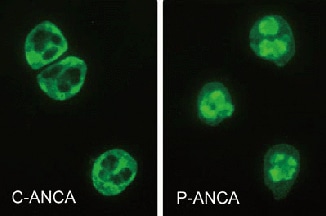 Antoantigen