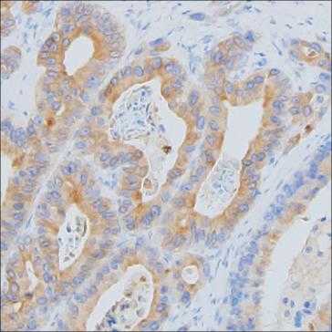 Anti-CCL2 monoclonal antibody, clone AB9858 (CABT-35123MH)