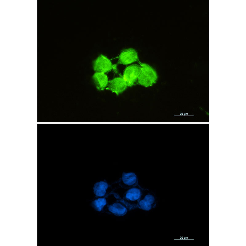 Rabbit Anti-SOD1 monoclonal antibody, clone KG2116 (CABT-37098RH)