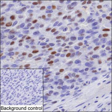 Mouse anti-Human P21 monoclonal antibody, clone 3H23 (CABT-B9262)