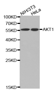 Anti-pan-AKT polyclonal antibody (CABT-BL021)