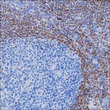 Mouse Anti-Human BCL2 monoclonal antibody, clone JID625 (CABT-L2818)