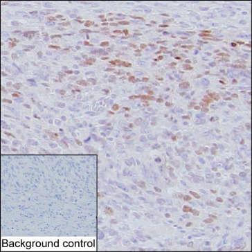 Mouse Anti-Human MyoD1 monoclonal antibody, clone JID741 (CABT-L2876)