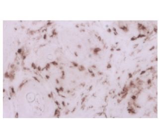 Rat Anti-Mouse CD4 Monoclonal antibody, clone GK1.5 (CABT-L4314)