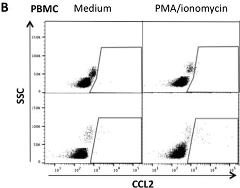 Mouse Anti-Horse CCL2 monoclonal antibody, clone 49 (CABT-ZB092)