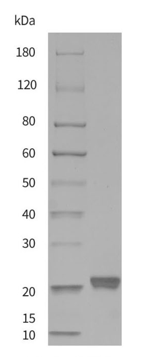 Recombinant Monkeypox Virus M1R Protein [His] (DAG-WT758)