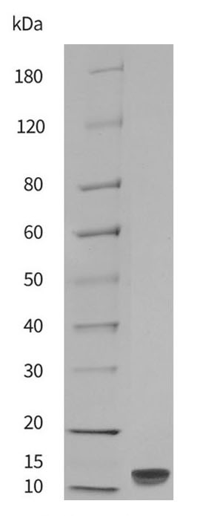 Recombinant Monkeypox Virus A29L Protein [His] (DAG-WT759)