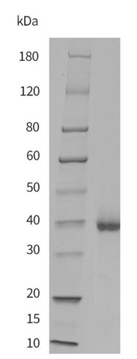 Recombinant Monkeypox Virus B6R Protein [His] (DAG-WT773)