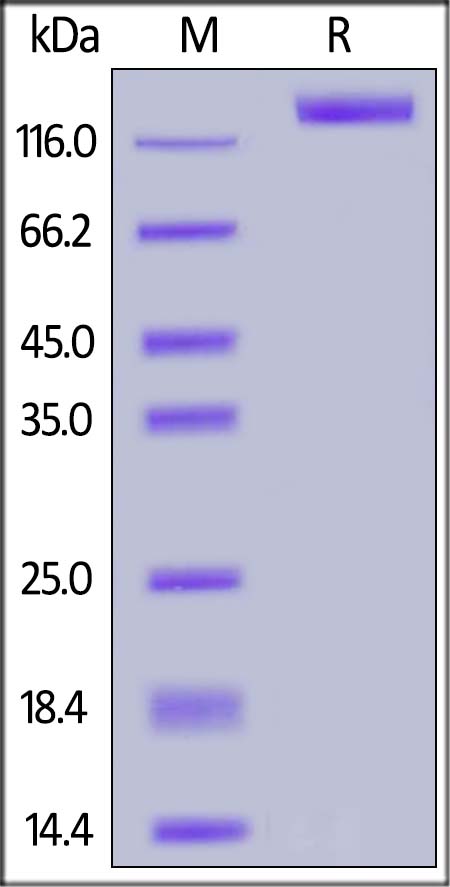 Recombinant SARS S protein (R667A) [His] (DAGC211)