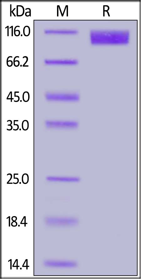 Recombinant SARS S1 protein [His] (DAGC216)