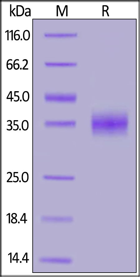 Recombinant SARS S protein RBD [His] (DAGC222)