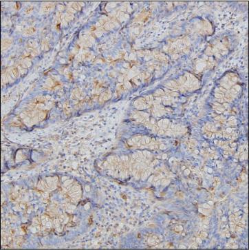 Anti-B2M monoclonal antibody, clone 5H6B2 (DCABH-7317)