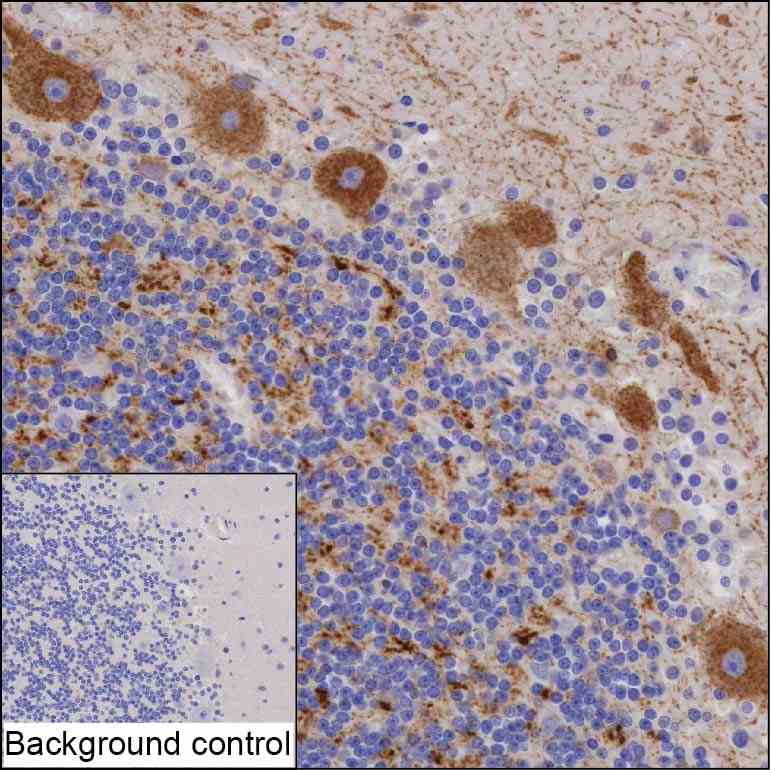 Anti-SNCG monoclonal antibody, clone 2I21E3 (DCABH-8924)