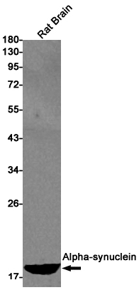 Rabbit Anti-Human SNCA Monoclonal Antibody, Clone S12-5F2 (DMAB-JX2362062)