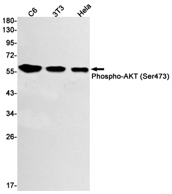 Rabbit Anti-Human Phospho-AKT (Ser473) Monoclonal Antibody, Clone S12-5I7 (DMAB-JX2362713)