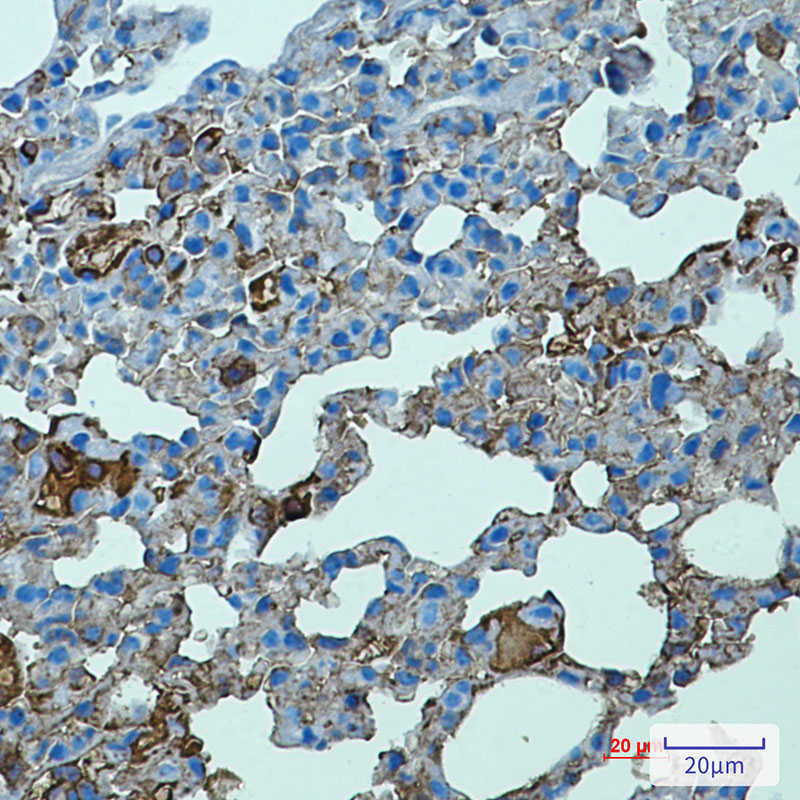 Rabbit Anti-Mouse TLR2 Monoclonal Antibody, Clone S17-9C7 (DMAB-JX2362729)