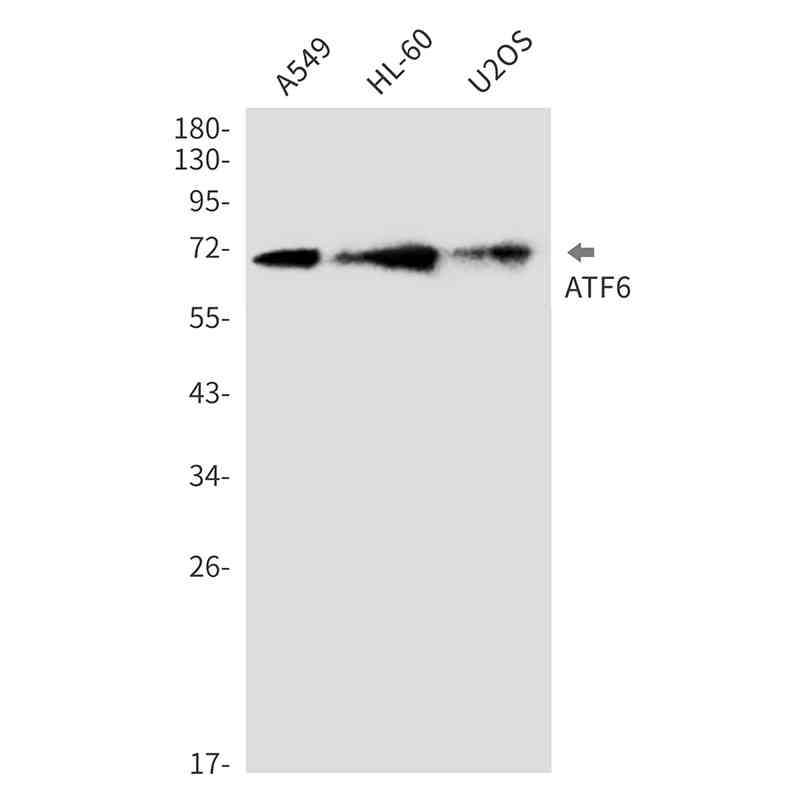 Rabbit Anti-Human ATF6 Monoclonal Antibody, Clone S16-5F8 (DMAB-JX2371009)