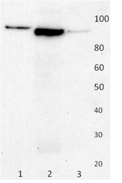 Rabbit Anti-Human Gelsolin Polyclonal Antibody (DPABB-JX52)