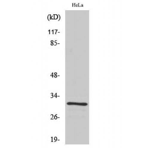 Rabbit Anti-Human IL1B Polyclonal Antibody (DPABH-06021)