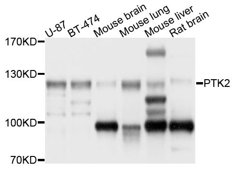 Rabbit Anti-Human PTK2 Polyclonal Antibody (DPABH-15770)