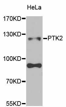 Rabbit Anti-Human PTK2 Polyclonal Antibody (DPABH-15832)