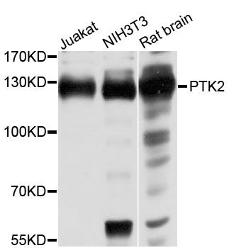 Rabbit Anti-Human PTK2 Polyclonal Antibody (DPABH-15835)