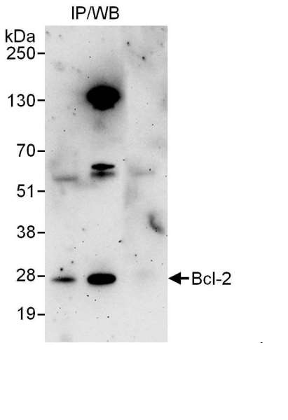 Rabbit Anti-Human BCL2 Polyclonal Antibody (DPABH-17957)