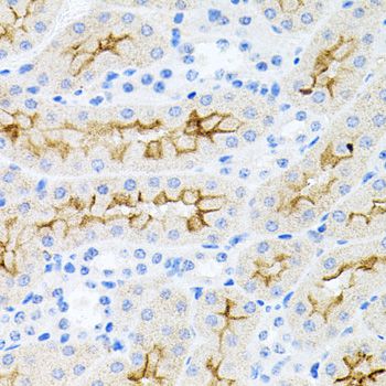 Rabbit Anti-Human IL17A Polyclonal Antibody (DPABH-22601)