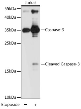 Rabbit Anti-Human CASP3 Polyclonal Antibody (DPABH-24873)