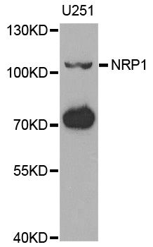 Rabbit Anti-Human NRP1 Polyclonal Antibody (DPABH-26510)