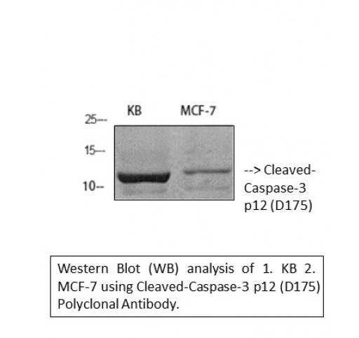 Rabbit Anti-Human CASP3 Polyclonal Antibody (DPABH-26796)