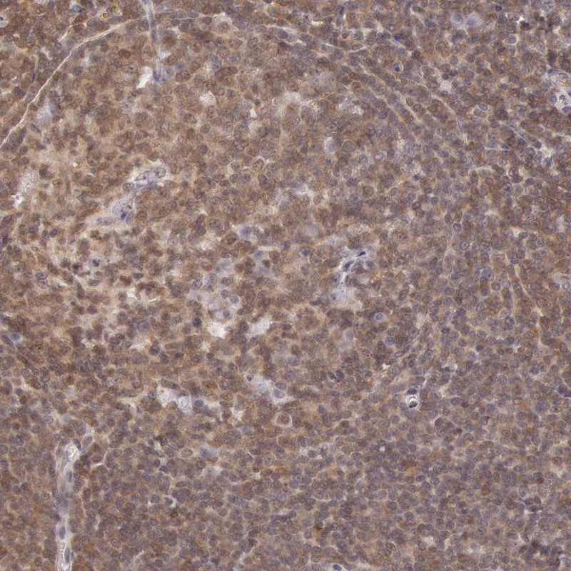 Rabbit Anti-Human HIF1A Polyclonal Antibody (DPABH-27162)