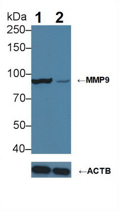 Mouse Anti-Human MMP-9 Monoclonal Antibody, clone 27 (CABT-L2062)