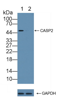 Rabbit Anti-Human CASP2 Polyclonal Antibody (CABT-L2088)
